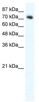 WB Suggested Anti-DVL1 Antibody Titration: 2.5 ug/ml; Positive Control: K562 cell lysateDVL1 is supported by BioGPS gene expression data to be expressed in K562