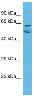 Host: Rabbit; Target Name: ZNF48; Sample Tissue: Lung Tumor lysates; Antibody Dilution: 1.0ug/ml