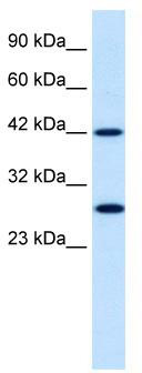 WB Suggested Anti-PSMD4 Antibody Titration: 0.3ug/ml; Positive Control: Raji cell lysatePSMD4 is strongly supported by BioGPS gene expression data to be expressed in Human Raji cells