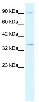 WB Suggested Anti-BHLHB5 Antibody Titration: 0.2-1 ug/ml; ELISA Titer: 1:62500; Positive Control: Jurkat cell lysate