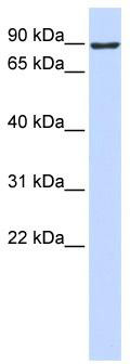 WB Suggested Anti-ATMIN Antibody Titration: 0.2-1 ug/ml; ELISA Titer: 1:31250; Positive Control: 293T cell lysateATMIN is supported by BioGPS gene expression data to be expressed in HEK293T