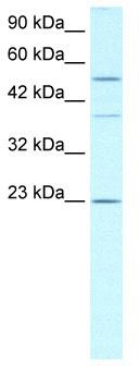 WB Suggested Anti-ZNFN1A1 Antibody Titration: 0.2-1 ug/ml; Positive Control: Daudi cell lysateIKZF1 is strongly supported by BioGPS gene expression data to be expressed in Human Daudi cells