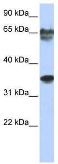 WB Suggested Anti-NKX3-2 Antibody Titration: 0.2-1 ug/ml; ELISA Titer: 1: 2500; Positive Control: Jurkat cell lysate