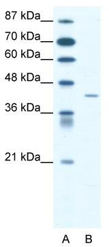 WB Suggested Anti-SSTR4 Antibody; Titration: 1.25 ug/ml; Positive Control: Jurkat Whole Cell