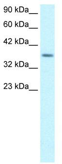 WB Suggested Anti-RPS16 Antibody Titration: 1.25 ug/ml; Positive Control: Jurkat cell lysate