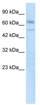 WB Suggested Anti-ZNF306 Antibody Titration: 0.2-1 ug/ml; Positive Control: Human Kidney