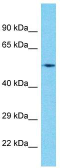 Host: Rabbit; Target Name: CIR1; Sample Tissue: Pancreas Tumor lysates; Antibody Dilution: 1.0 ug/ml