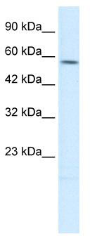 WB Suggested Anti-TPH2 Antibody Titration: 0.2-1 ug/ml; Positive Control: HepG2 cell lysate