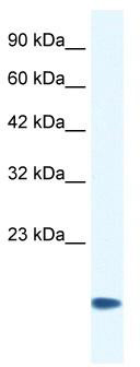 WB Suggested Anti-CSRP3 Antibody Titration: 0.2-1 ug/ml; ELISA Titer: 1:62500; Positive Control: Human heart