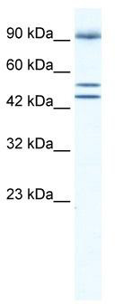 WB Suggested Anti-BRD2 Antibody Titration: 0.2-1 ug/ml; ELISA Titer: 1:62500; Positive Control: Jurkat cell lysate; BRD2 is strongly supported by BioGPS gene expression data to be expressed in Human Jurkat cells