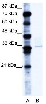 WB Suggested Anti-PCGF4 Antibody Titration: 0.2-1 ug/ml; ELISA Titer: 1:312500; Positive Control: A172 cell lysate; BMI1 is supported by BioGPS gene expression data to be expressed in A172