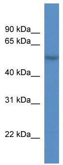 WB Suggested Anti-CDR2L Antibody Titration: 0.2-1 ug/ml; ELISA Titer: 1:500; Positive Control: OVCAR-3 cell lysate. CDR2L is supported by BioGPS gene expression data to be expressed in OVCAR3