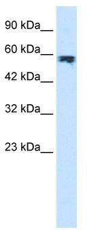 WB Suggested Anti-ZYX Antibody Titration: 1.25 ug/ml; ELISA Titer: 1:62500; Positive Control: Jurkat cell lysate