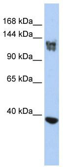 WB Suggested Anti-SMARCA1 Antibody Titration: 0.2-1 ug/ml; ELISA Titer: 1:312500; Positive Control: Jurkat cell lysate
