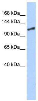 WB Suggested Antibody Titration: 0.2-1 ug/ml; Positive Control: 293T; ELISA Titer: 1:12500SMARCA1 is strongly supported by BioGPS gene expression data to be expressed in Human HEK293T cells