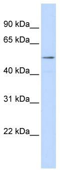 WB Suggested Anti-SUV420H1 Antibody; Titration: 1.25 ug/ml; Positive Control: Jurkat Whole Cell
