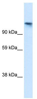 WB Suggested Anti-TIP120A Antibody Titration: 1.25 ug/ml; ELISA Titer: 1:62500; Positive Control: Human brain