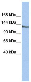 WB Suggested Anti-SMARCAD1 Antibody Titration: 0.2-1 ug/ml; ELISA Titer: 1:62500; Positive Control: HepG2 cell lysate