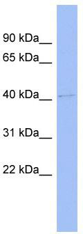 WB Suggested Anti-BTBD6 Antibody Titration: 0.2-1 ug/ml; ELISA Titer: 1:62500; Positive Control: Human Small Intestine