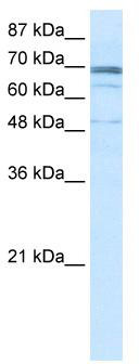 WB Suggested Anti-ZNF614 Antibody Titration: 0.2-1 ug/ml; ELISA Titer: 1:12500; Positive Control: Jurkat cell lysate