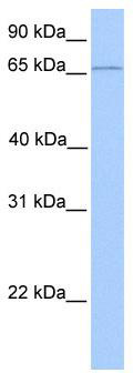 WB Suggested Anti-CLCNKA Antibody Titration: 0.2-1 ug/ml; Positive Control: Human Liver