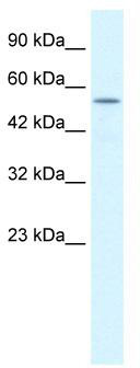 WB Suggested Anti-KCNK10 Antibody Titration: 1.4 ug/ml; ELISA Titer: 1:312500; Positive Control: Jurkat cell lysate