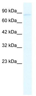 WB Suggested Anti-GRIK2 Antibody Titration: 2.5 ug/ml; ELISA Titer: 1:62500; Positive Control: Jurkat cell lysate