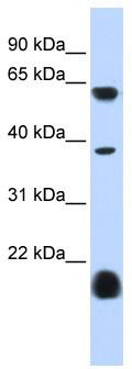 WB Suggested Anti-HTR3E Antibody Titration: 0.2-1 ug/ml; ELISA Titer: 1:312500; Positive Control: Human heart