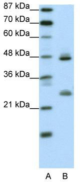 WB Suggested Anti-KLF6 Antibody Titration: 0.2-1 ug/ml; ELISA Titer: 1:312500; Positive Control: Transfected 293T