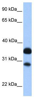WB Suggested Anti-CITED2 Antibody Titration: 0.2-1 ug/ml; Positive Control: Human brain