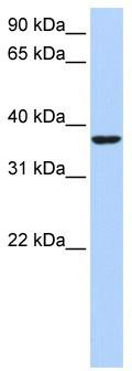WB Suggested Anti-HMG20B Antibody Titration: 0.2-1 ug/ml; ELISA Titer: 1:62500; Positive Control: HepG2 cell lysate
