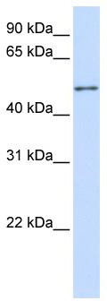WB Suggested Anti-ZNF561 Antibody Titration: 0.2-1 ug/ml; ELISA Titer: 1:12500; Positive Control: 293T cell lysate