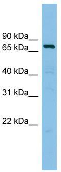 WB Suggested Anti-AKAP10 Antibody Titration: 0.2-1 ug/ml; ELISA Titer: 1:312500; Positive Control: RPMI 8226 cell lysate