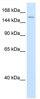 WB Suggested Anti-DHX9 Antibody Titration: 0.2-1 ug/ml; ELISA Titer: 1:62500; Positive Control: Transfected 293T