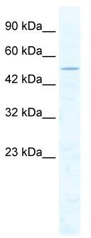 WB Suggested Anti-CHD1L Antibody Titration: 2.5 ug/ml; ELISA Titer: 1:312500; Positive Control: Jurkat cell lysateCHD1L is strongly supported by BioGPS gene expression data to be expressed in Human Jurkat cells