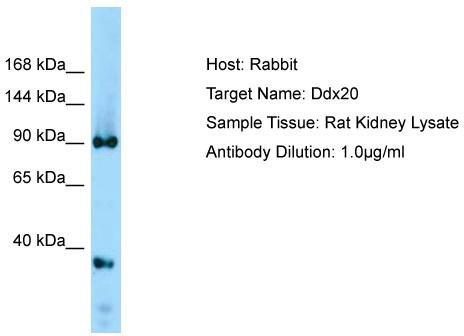 Host: Rabbit; Target Name: Ddx20; Sample Tissue: Rat Kidney lysates; Antibody Dilution: 1.0 ug/ml