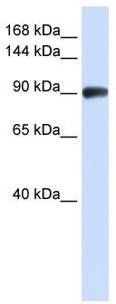 WB Suggested Anti-RAD54B Antibody Titration: 0.2-1 ug/ml; ELISA Titer: 1:62500; Positive Control: Jurkat cell lysateRAD54B is supported by BioGPS gene expression data to be expressed in Jurkat