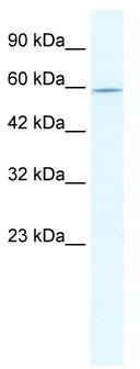 WB Suggested Anti-DDX47 Antibody Titration: 2.5 ug/ml; ELISA Titer: 1:1562500; Positive Control: Jurkat cell lysate