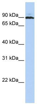 WB Suggested Anti-PEO1 Antibody Titration: 0.2-1 ug/ml; ELISA Titer: 1:62500; Positive Control: Jurkat cell lysate