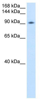 WB Suggested Anti-DDX54 Antibody Titration: 0.2-1 ug/ml; ELISA Titer: 1:312500; Positive Control: Transfected 293T
