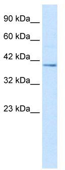 WB Suggested Anti-NUCB2 Antibody Titration: 2.5 ug/ml; ELISA Titer: 1:312500; Positive Control: HepG2 cell lysate