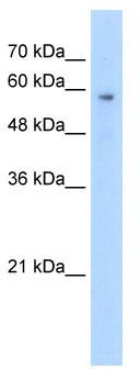 WB Suggested Anti-TPTE Antibody Titration: 2.5 ug/ml; Positive Control: Jurkat cell lysate