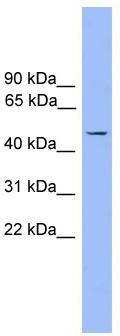 WB Suggested Anti-Foxj1 Antibody Titration: 0.2-1 ug/ml; ELISA Titer: 1:312500; Positive Control: Mouse Heart
