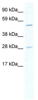 WB Suggested Anti-ASCL2 Antibody Titration: 5.0 ug/ml; ELISA Titer: 1:312500; Positive Control: Human Small intestine