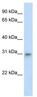 WB Suggested Anti-TFAM Antibody Titration: 0.2-1 ug/ml; ELISA Titer: 1:62500; Positive Control: NIH/3T3 cell lysate