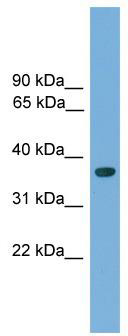 WB Suggested Anti-Hoxa1 Antibody Titration: 0.2-1 ug/ml; Positive Control: Mouse Small Intestine