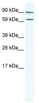 WB Suggested Anti-MTA2 Antibody Titration: 5.0 ug/ml; ELISA Titer: 1:312500; Positive Control: NIH/3T3 cell lysate