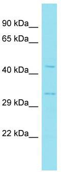 Host: Rabbit; Target Name: Hnf4g; Sample Tissue: Mouse Testis lysates; Antibody Dilution: 1.0 ug/ml