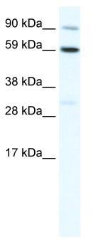WB Suggested Anti-TBX21 Antibody Titration: 1.25 ug/ml; ELISA Titer: 1:312500; Positive Control: SP2/0 cell lysate