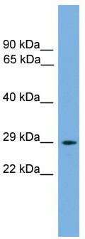 WB Suggested Anti-Nrip2 Antibody Titration: 0.2-1 ug/ml; ELISA Titer: 1:312500; Positive Control: Mouse Thymus